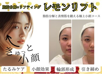 イーズスリミングプロ 横浜コレットマーレ店/20代レモンボトル/毛穴/小顔