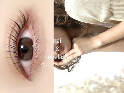 ソナ(sona)の写真