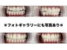 【お試しホワイトニング回数券】４回コース+１回分ホワイトニングプレゼント