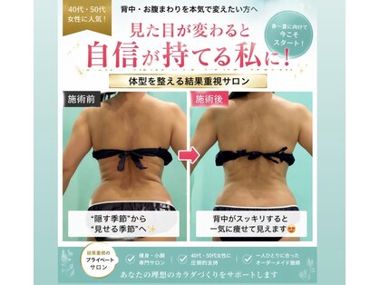 アカツキファイブ(AKATSUKI5)の写真