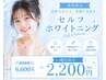 【医療提携セルフホワイトニング】黄ばみ・着色に◎清潔感ある白い歯へ♪
