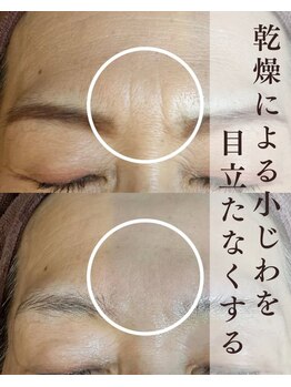 デェア コミータ/肌質改善ナノプラズマ