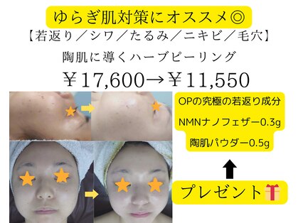 リノカピリナ(Lino ka pilina)の写真