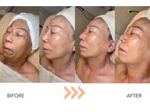 エングラッシー(en glassy)/BEFORE　AFTER　50代