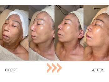 エングラッシー(en glassy)/BEFORE　AFTER　50代