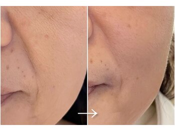 エステドブルー(Este de Bleu)/ビフォーアフター