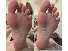 メグムサロン(Megumu Salon)/足のむくみスッキリ！！！