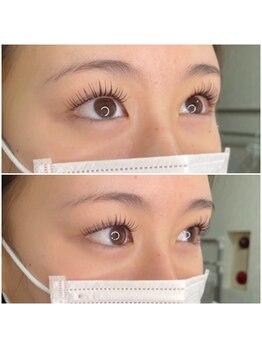 グリッターネイル(GLITTER NAILS)/アンドヘルシー