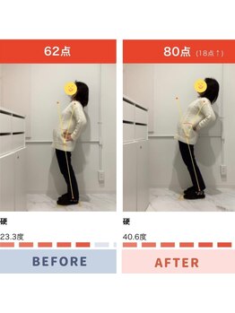 レピア 夙川本店(Lepia)/ビフォーアフターのご紹介♪