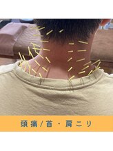 いつつのき/運動鍼