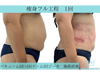 リメイククリニカルビューティー(Remake clinical beauty)/圧倒的変化!