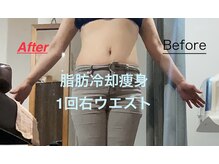 セルリアンブルー(Cerulean Blue)/1回でこの結果！