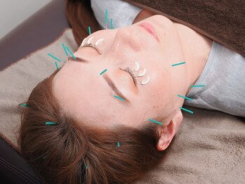 トラスト整骨院鍼灸院/筋肉やツボの位置を刺激!