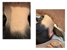 ビューティ ケア ルーム メロウ(Beauty Care Room Moelleux)/うなじ脱毛