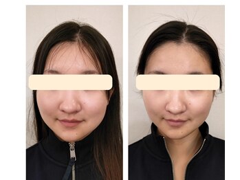 カレーズ 夙川店(Karez)/お顔の面積が3分の2に