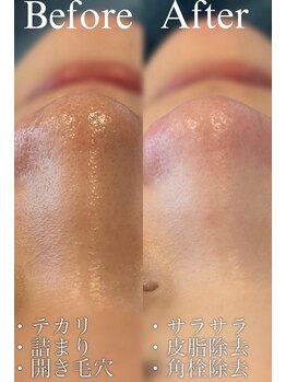 マシロ(MA SHIRO)/泡ピーリング×毛穴洗浄