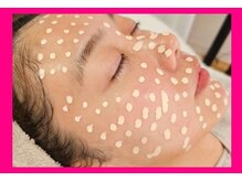 アン 銀座(ann)/#メソスキンカラー