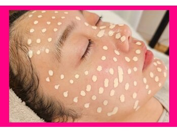 アン 銀座(ann)/#メソスキンカラー