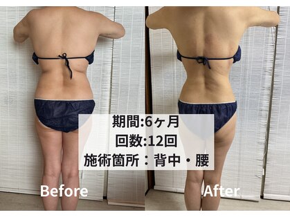 クライオ360(Cryo360)の写真