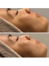 ビュウナ 銀座(BEAUNA)/シルクブライト