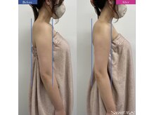 ユフラ(Juhla)/全身深部高周波＋オイル