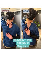 アンティオール 大森本店/Before→After【肩のお悩み】