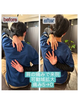 アンティオール 大森本店/Before→After【肩のお悩み】