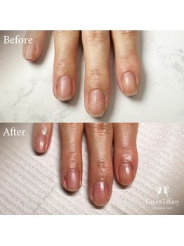 グリーンティファニー 麻布十番(Green Tiffany)/ビフォーアフター1回