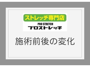 プロストレッチ/プロストレッチのbefore/after◎