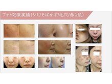 ルナイーズ(Luna Ease)の雰囲気（最新シミケアマシン導入店♪）