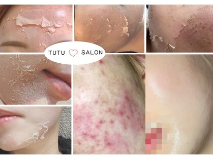 チュチュ(TUTU)の写真