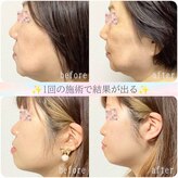 小顔整体 優