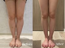 モリタ鍼灸整骨院/運動なしでもここまで変わる！