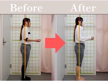 やわた姿勢整体院/30歳女性
