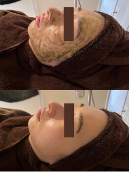 アイル 玉造店(iru)/最初はソフトから