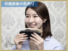 ライトケアサロン 銀座店(Light Care Salon)/セルフホワイトニングの手順