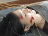 【ほうれい線ケア】美しさを引き出す、美容鍼灸の魔法¥12,100→¥4,980