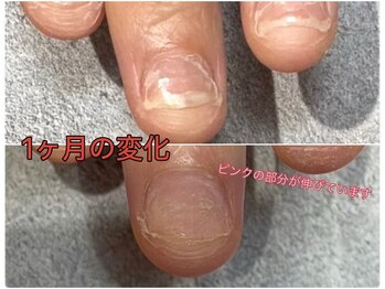 グレースレディ 神戸北店/