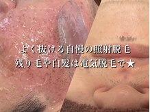 エチ毛ットの雰囲気（痛すぎず通い易い、濃い髭もよく抜け◎白髪や残り毛処理も大人気）