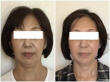 美容整体ウェリナ あま甚目寺院/小顔矯正/骨盤矯正/美脚サロン