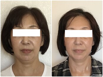 美容整体ウェリナ あま甚目寺院/小顔矯正/骨盤矯正/美脚サロン