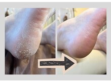 フットタイムズ(FOOT TIMES)の雰囲気(引っかかるかかとも一度のケアでここまで綺麗に◎)