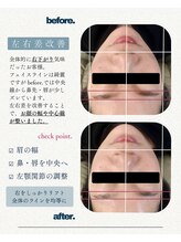メイジーネイル(Maisie Nail)/小顔矯正