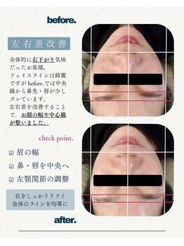 メイジーネイル(Maisie Nail)/小顔矯正