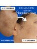 【お肌の悩みあるなら】発光美艶ピーリング【ご新規様￥13200→￥6600】