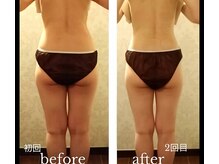 バービーホリック(barbie holic)/１３０分コース　初回と２回目