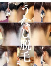 エリス(ELISSE)/振袖にはうなじ脱毛