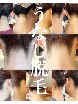 エリス(ELISSE)/振袖にはうなじ脱毛