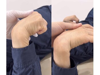 ランドル(rendre)/手首の硬さ