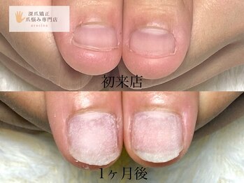 グレースレディ 神戸北店/